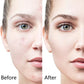 6-in-1 Microneedling Derma Roller Kit